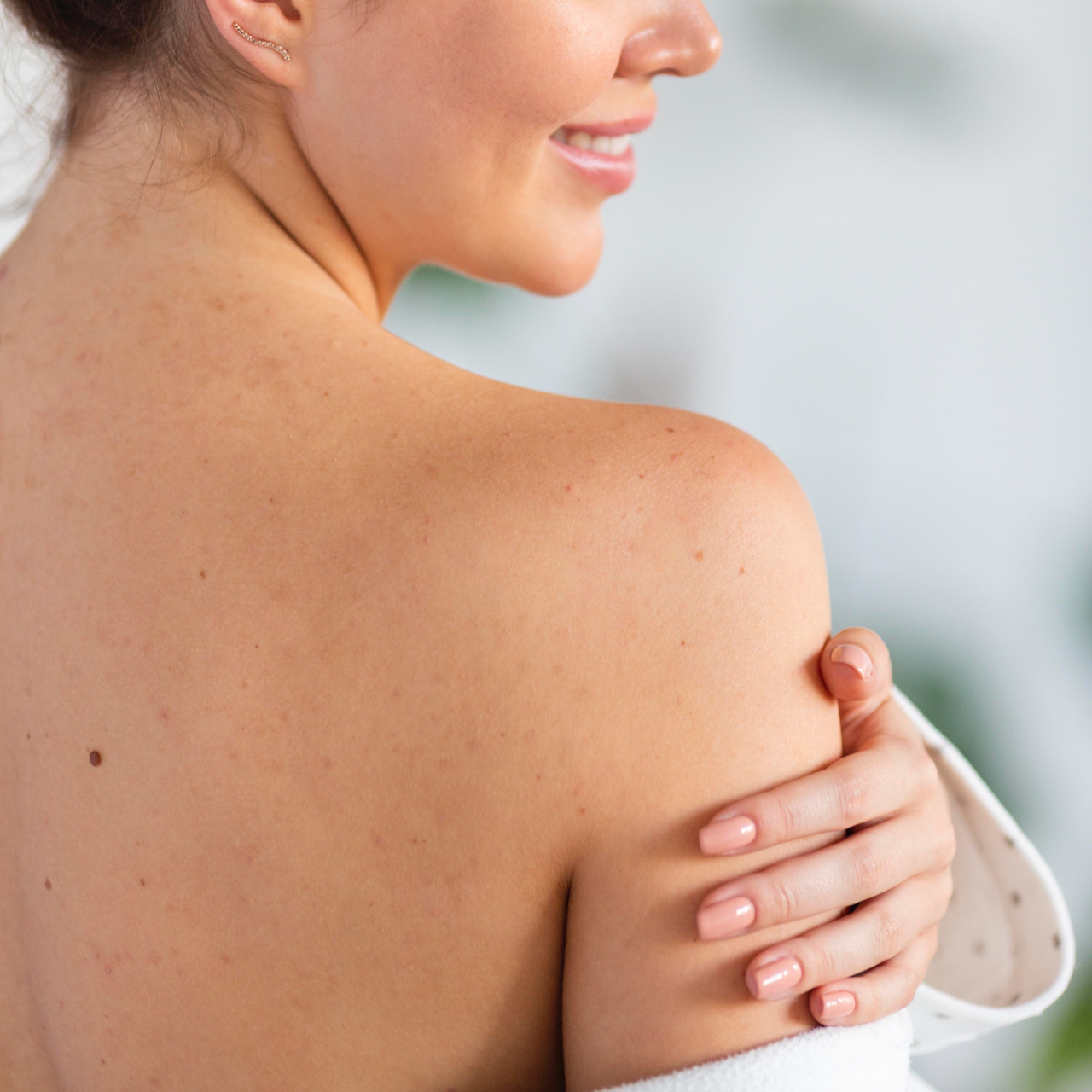 Lumecca-IPL-Treatment.png